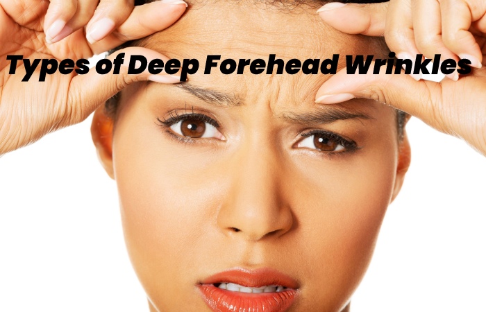 Types of Deep Forehead Wrinkles