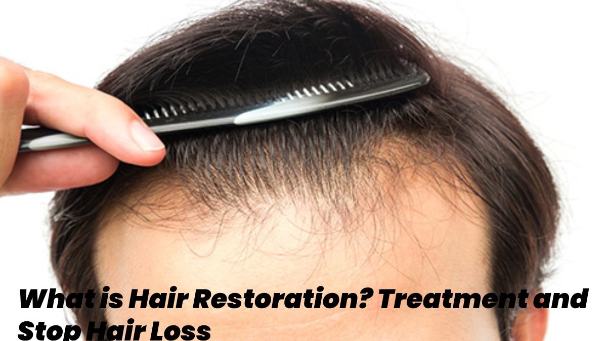 What is Hair Restoration? – Treatment and Stop Hair Loss