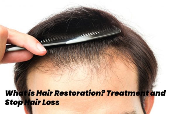 hair restoration