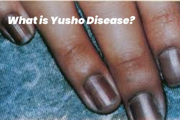yusho disease