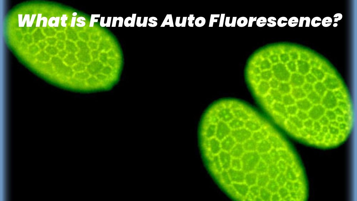 What is Fundus Auto Fluorescence?