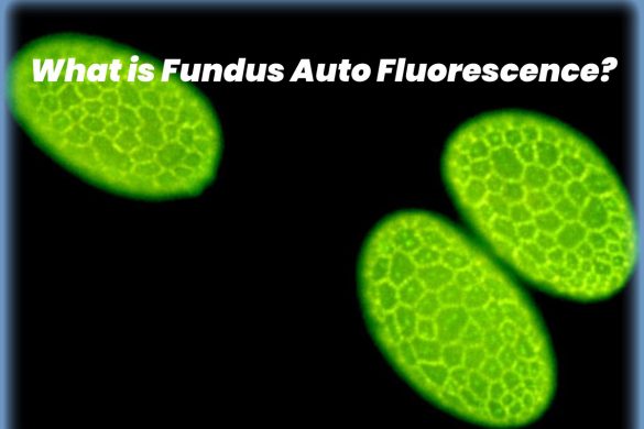 fundus auto fluorescence