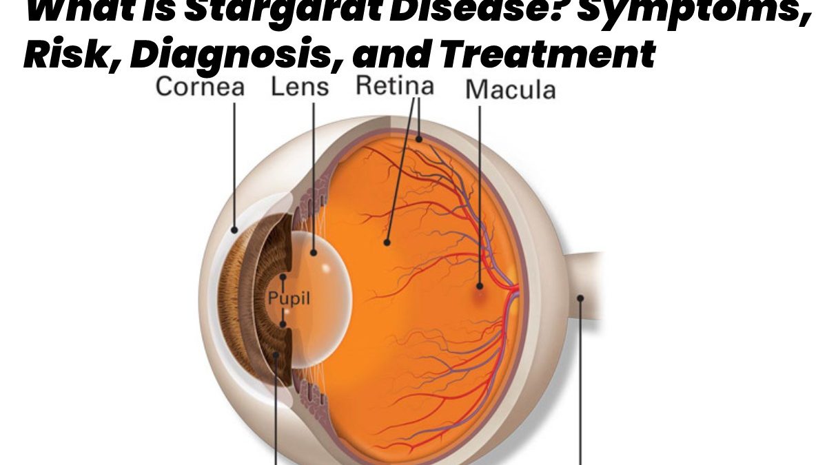 What is Stargardt Disease? – Symptoms, Risk, Diagnosis, and Treatment