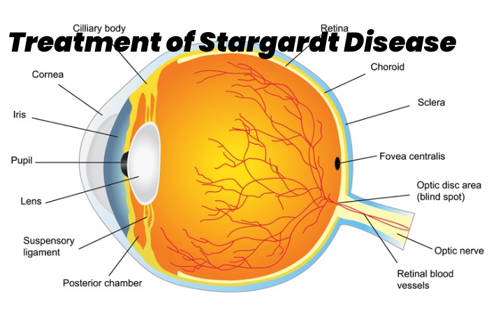 Treatment of Stargardt Disease