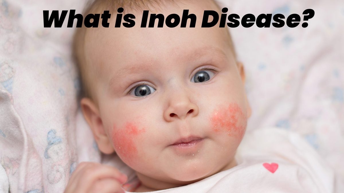 What is Inoh Disease?