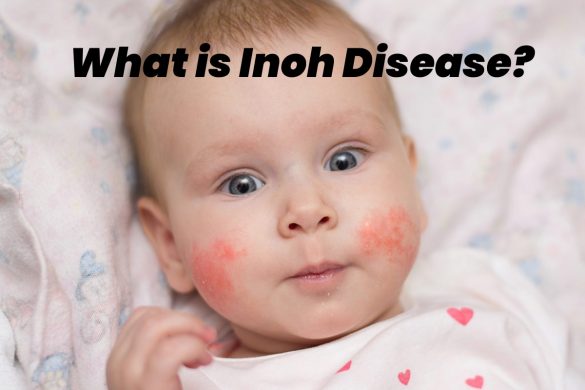 inoh disease