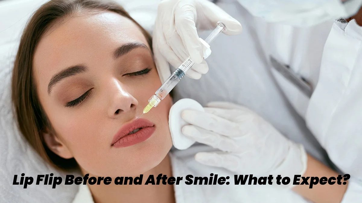 Lip Flip Before and After Smile – What to Expect?