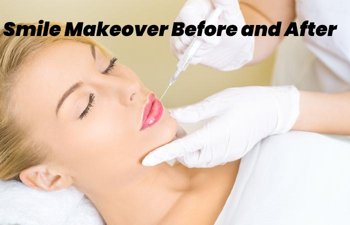 Smile Makeover Before and After