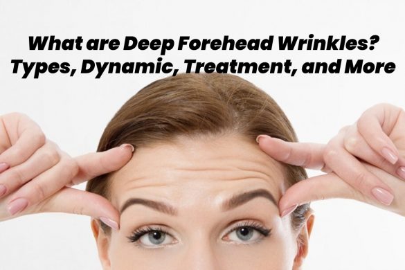deep forehead wrinkles