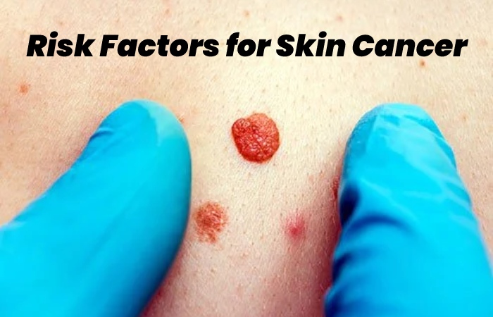 Risk Factors for Skin Cancer