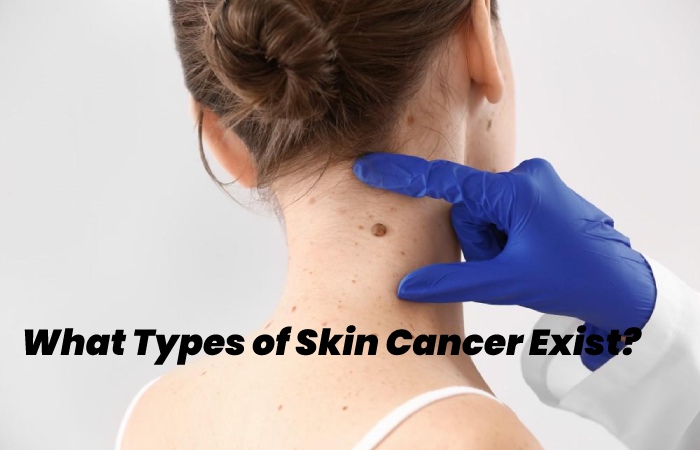 What Types of Skin Cancer Exist?