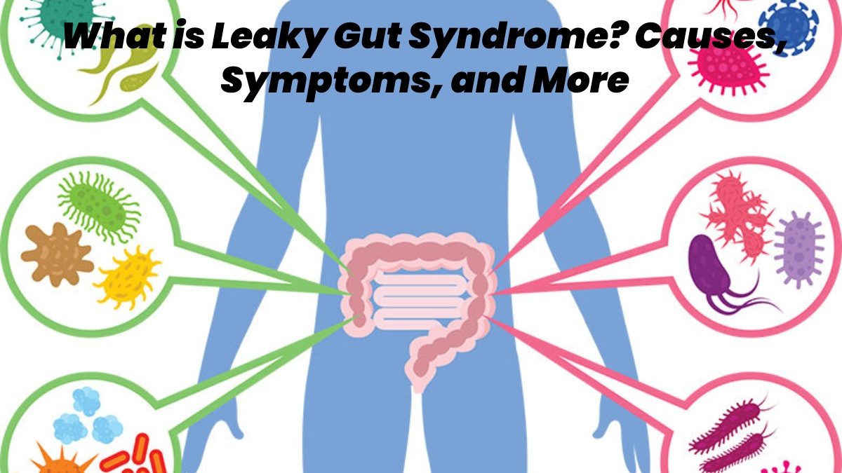 What is Leaky Gut Syndrome? – Causes, Symptoms, and More