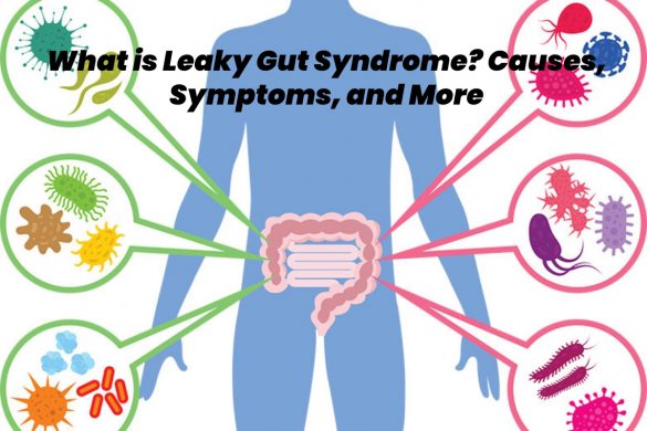 leaky gut syndrome