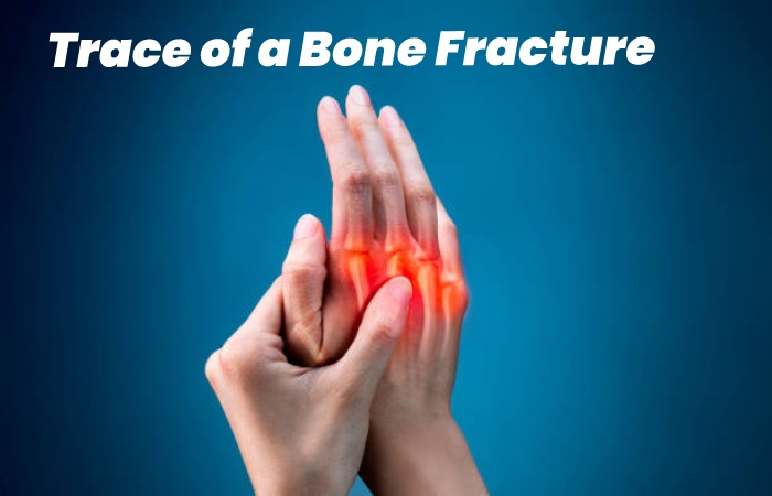 Trace of a Bone Fracture