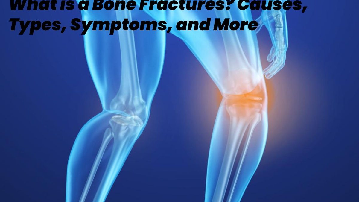 What is a Bone Fracture? – Causes, Types, Symptoms, and More