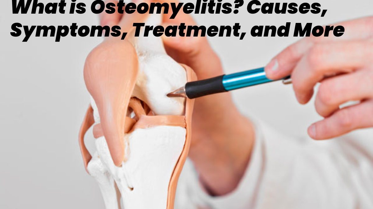 What is Osteomyelitis? – Causes, Symptoms, Treatment, and More