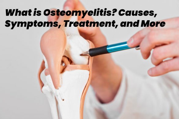 osteomyelitis