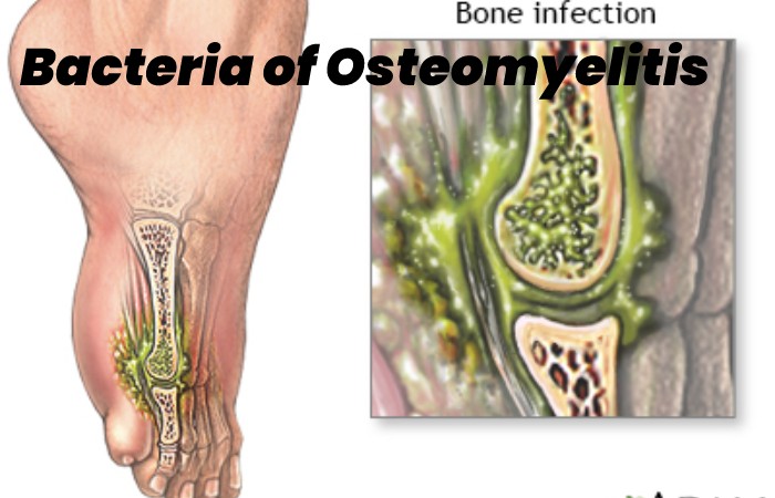 Bacteria of Osteomyelitis