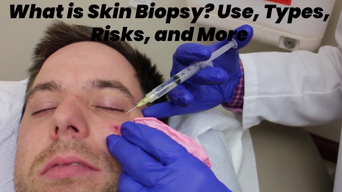 What is Skin Biopsy? – Use, Types, Risks, and More