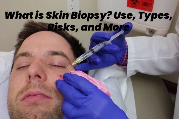 skin biopsy