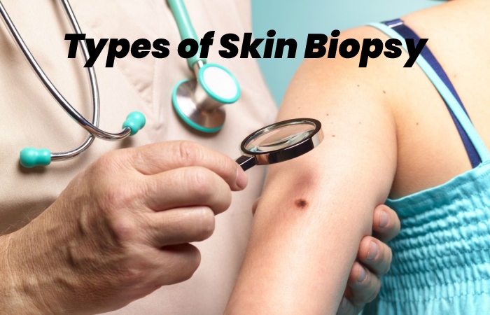 Types of Skin Biopsy