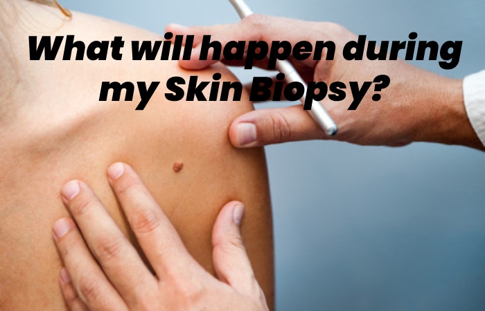 What will happen during my Skin Biopsy?